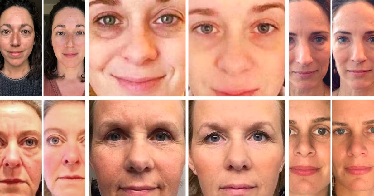 Before and after results of a jade face roller facial massage