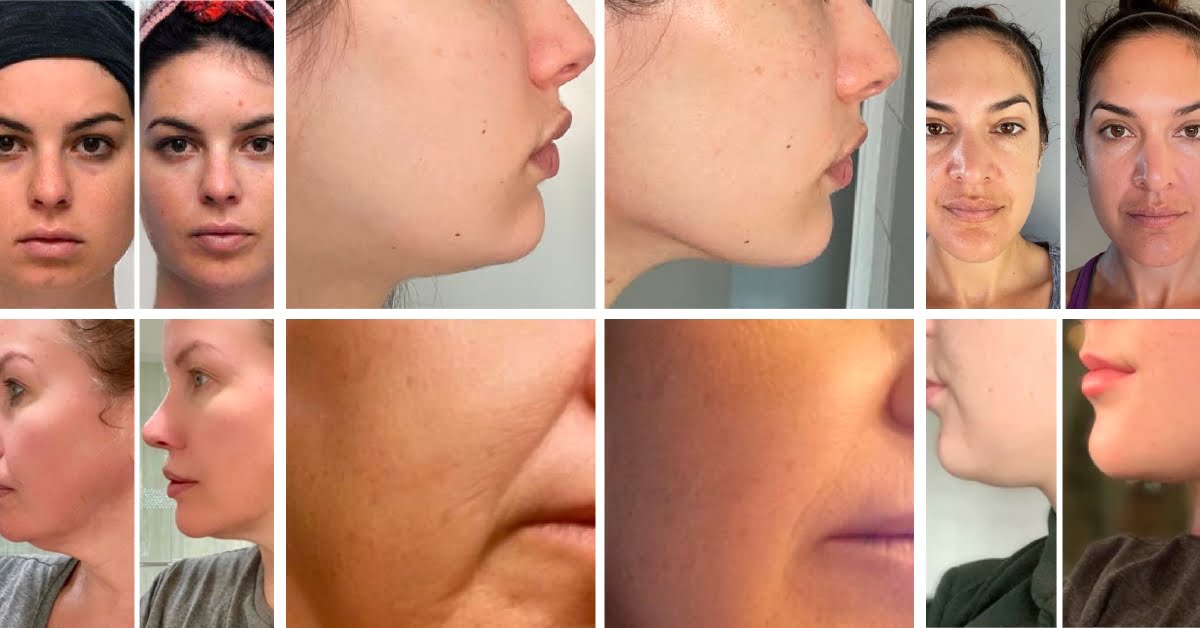 Results before after massage face gua sha